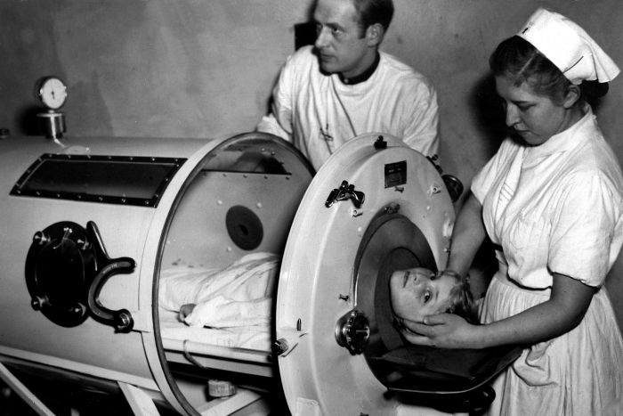 Искусственная вентиляция легких - железное легкое 1952 год