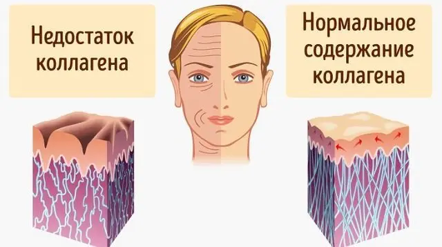 зачем нужен коллаген