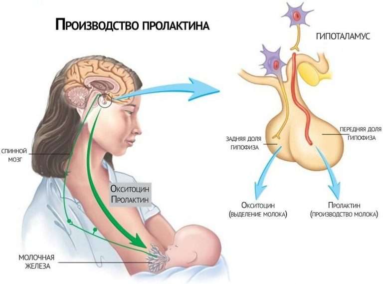 Синдром гиперпролактинемии