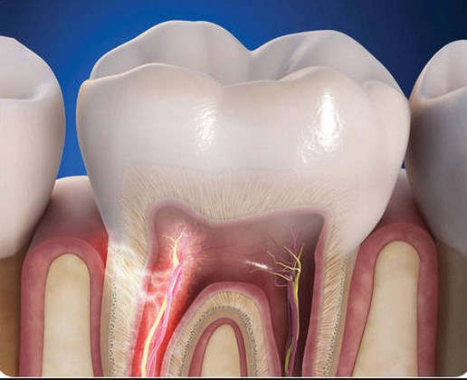 Почему зубы могут быть чувствительными? Как снизить чувствительность зубов?