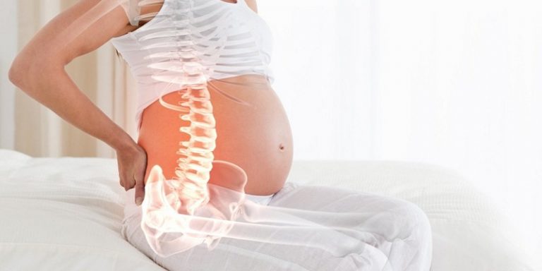 влияние сколиоза на беременность