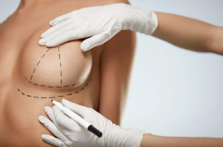 операция по увеличению груди