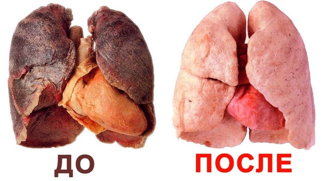 легкие до и после курения