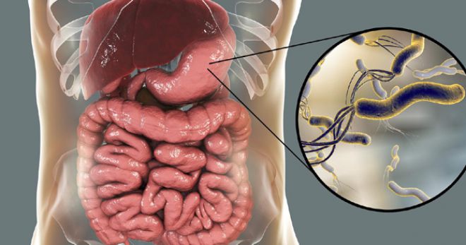 лечение хеликобактерной инфекции