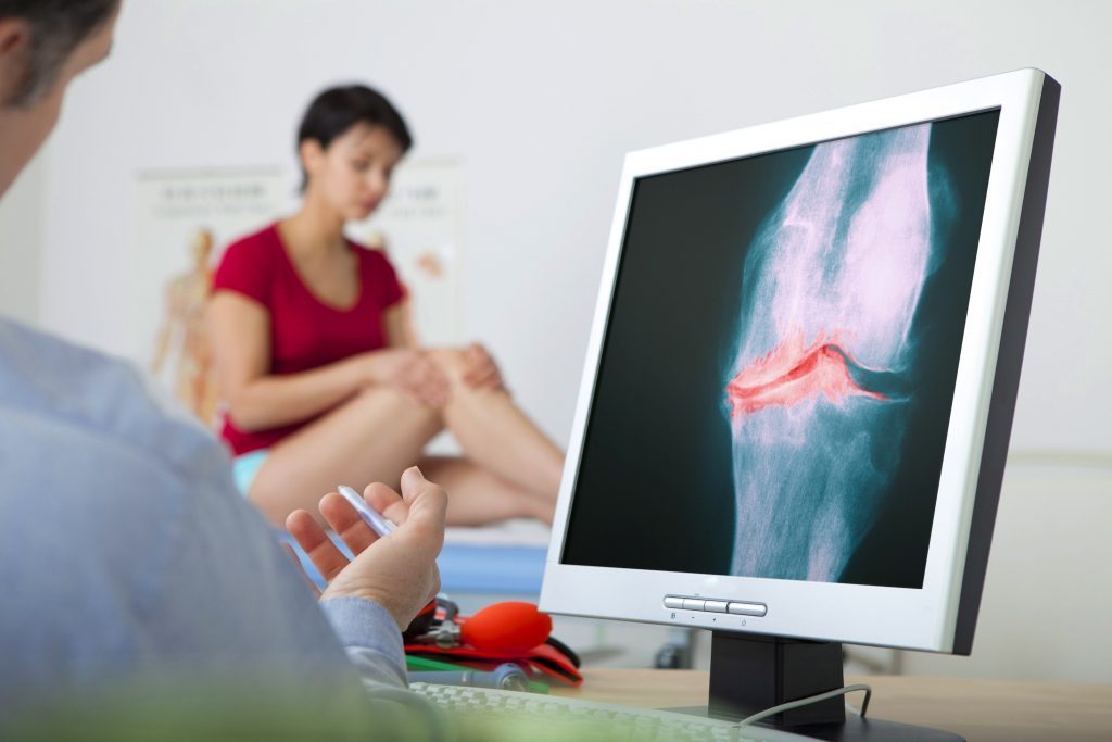 Почему болят колени и что делать? Вопрос ревматологу