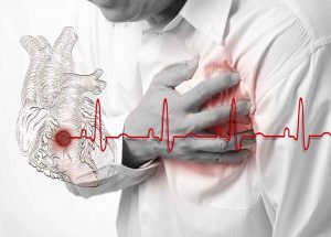 болезни сердца и сосудов
