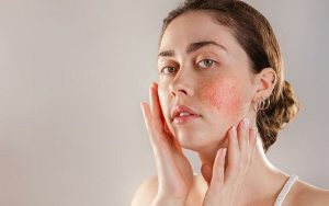 Чем может быть спровоцировано состояние гиперчувствительной кожи?