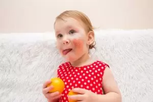 аллергия на апельсин