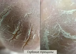 глубокие трещины