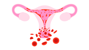 менструация