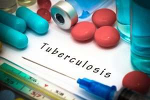 лечение туберкулеза