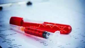 гемофилия А