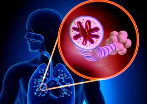 Какую роль в развитии астмы играет аллергия?