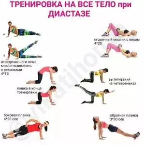 можно выполнять при диастазе