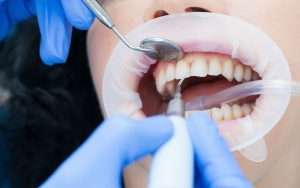 Сколько стоит стоматология