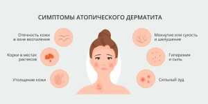 симптомы атопического дерматита