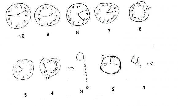 Тест на выявление деменции "Рисование часов"