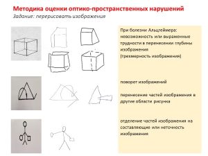 тест на Альцгеймера