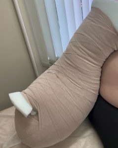 бандажирование