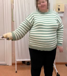 результат лечения